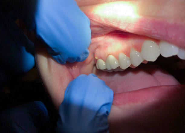 Best Broken or Cracked Tooth Emergency Dentist in Paul, ID
